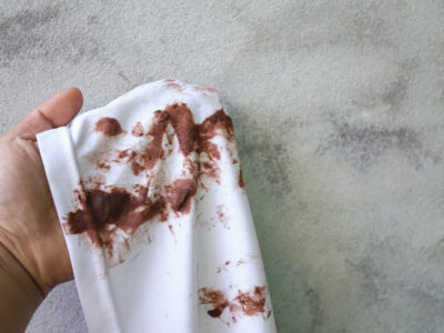 hand showing chocolate stain on clothes