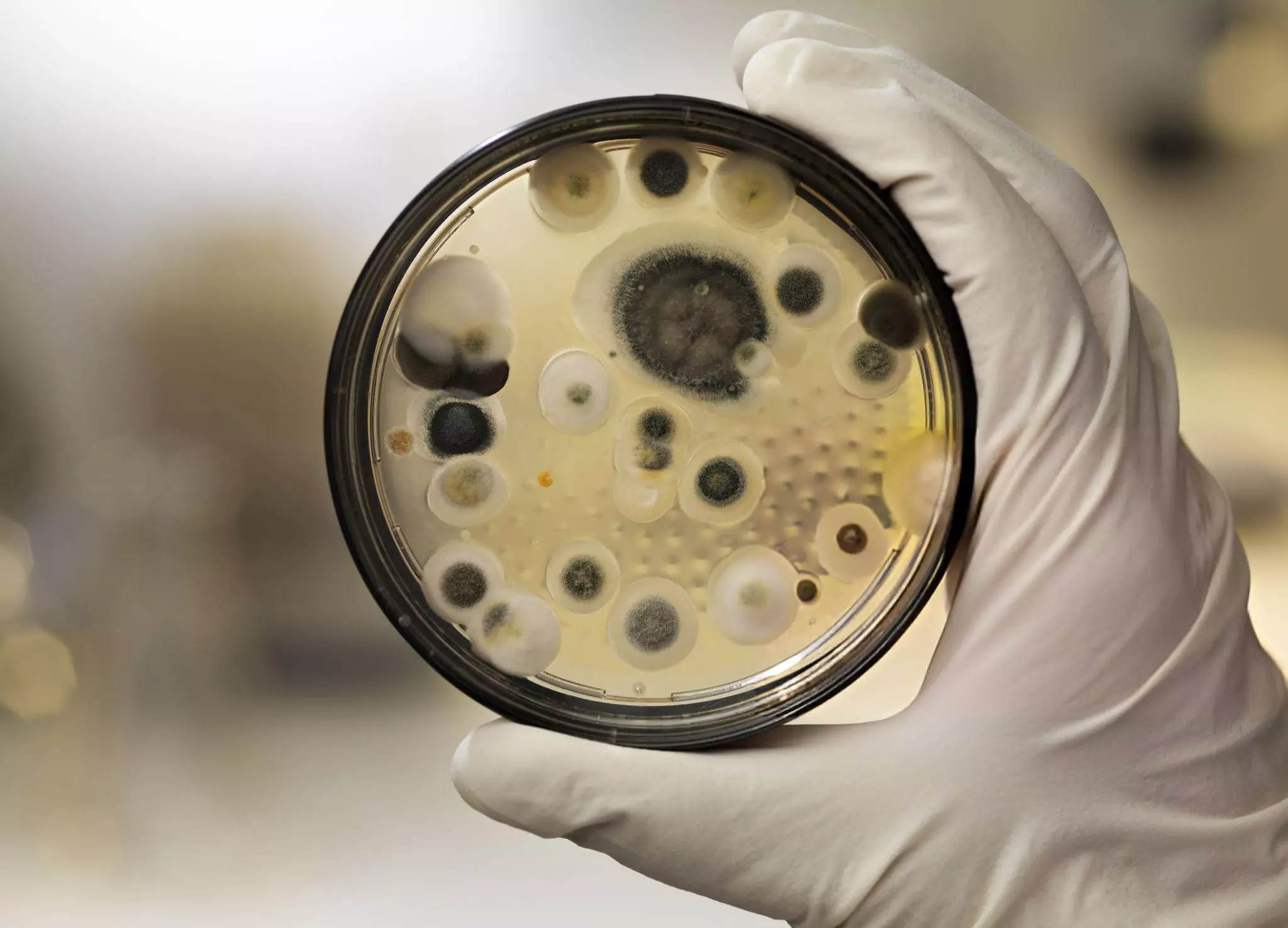 What Does Black Mold Look Like Cleanzen Image of a Mildew Culture on Agar Plate